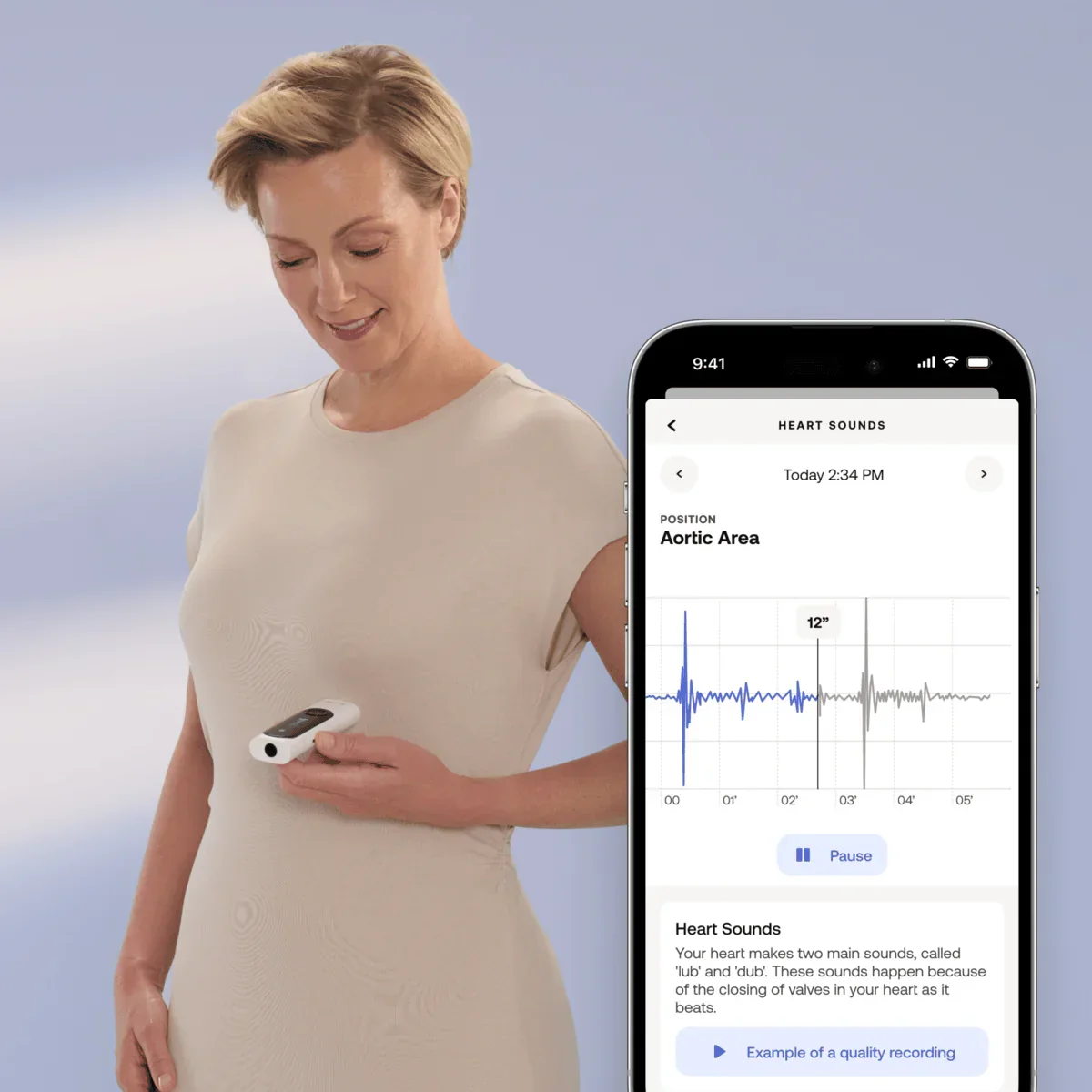 Withings Beam-O - Dispozitiv MultiScan 4 in 1 de evaluare a sanatatii (termometru, EKG, SPO2, stetoscop digital) - Image 7